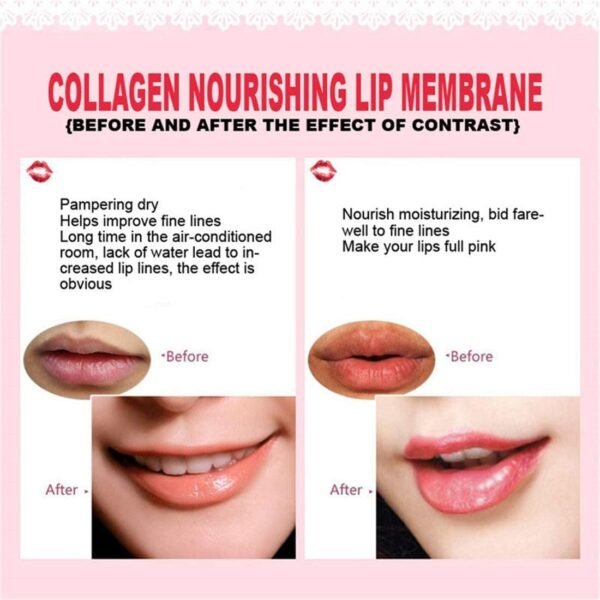 Lip Ice Pack for Cosmetic - Image 3