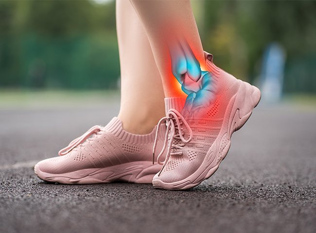 ankle sprains