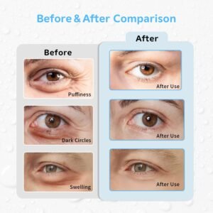 eye ice pack set