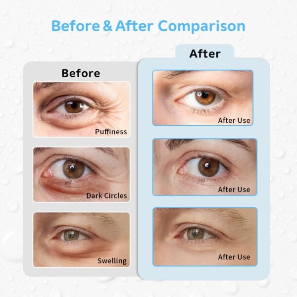 eye ice pack set